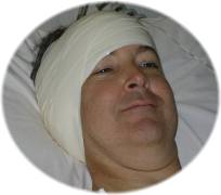 Post-op picture of Dan